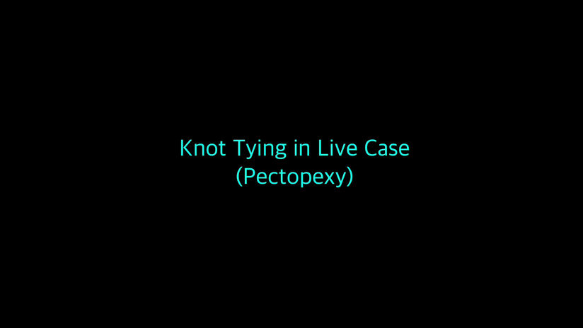 SAY Knot